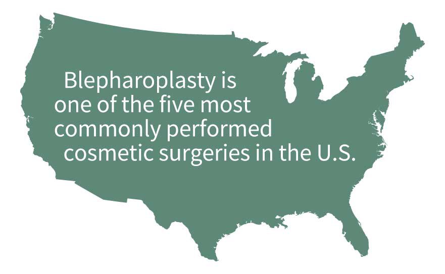 Connecticut blepharoplasty infographic